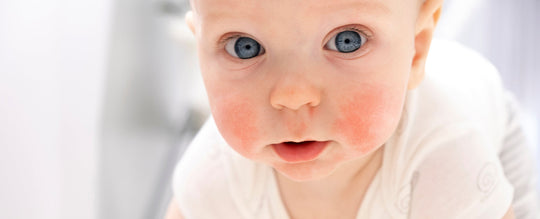 Die tägliche Hautpflege-Routine bei Kindern mit atopischer Haut: Tipps für die Eltern