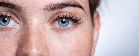 Dermatitis und empfindliche Augen: gibt es einen Zusammenhang?